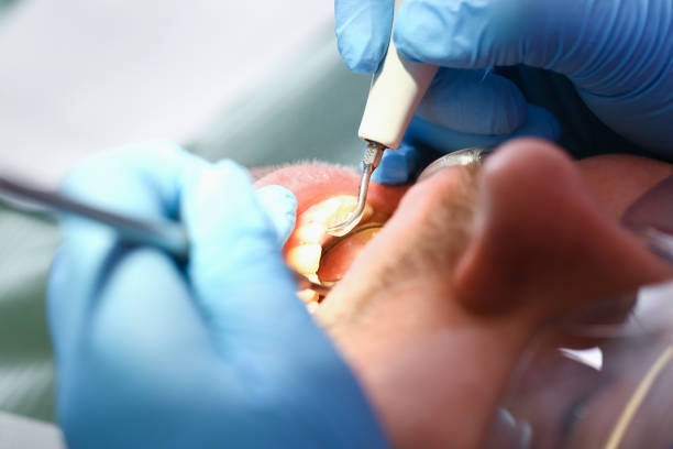 Best Walk-In Emergency Dental Services in Searingtown, NY