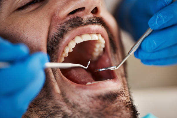 Best Emergency Care for Gum Disease in Searingtown, NY
